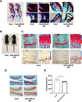 miR-23a/b clusters are not essential for the pathogenesis of osteoarthritis in mouse aging and post-traumatic models